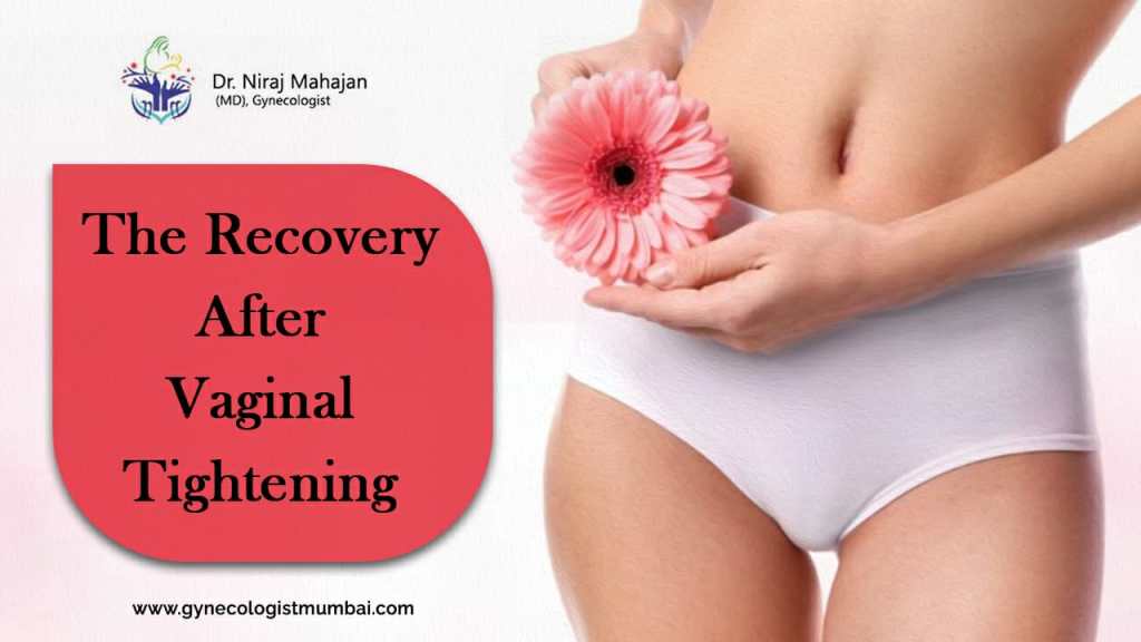 Benefits and Recovery Process of Vaginal Tightening Surgery
